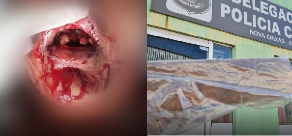 Homem tenta matar ex-esposa com uma vigota