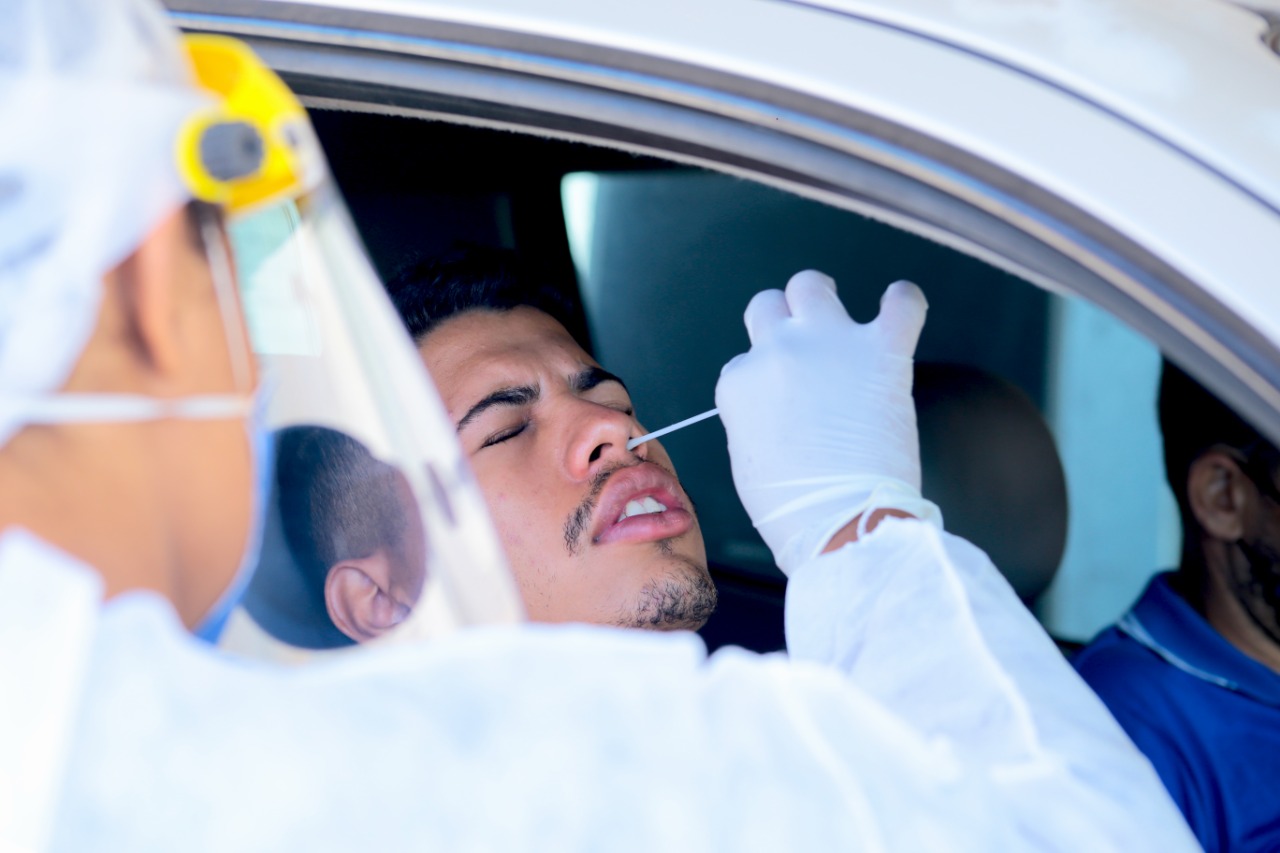 Anvisa estende validade de testes diagnósticos de Covid-19