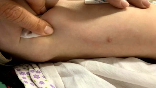 Médica chama a polícia depois de perceber 30 lesões em corpo de bebê