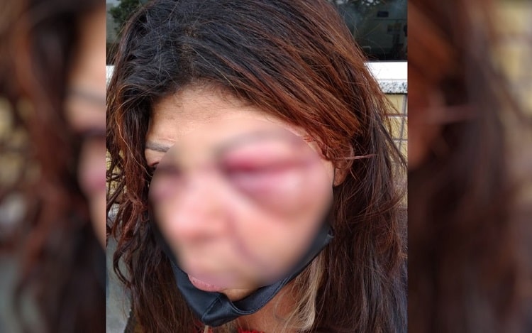 Sogra denuncia que foi espancada pelo genro em Goiânia