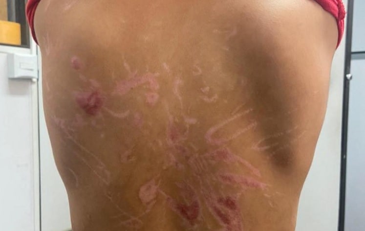 Pai é preso sob suspeita de torturar o filho com sessões de choque e afogamento