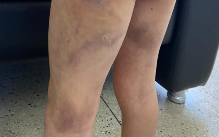 crianca-agredida--min