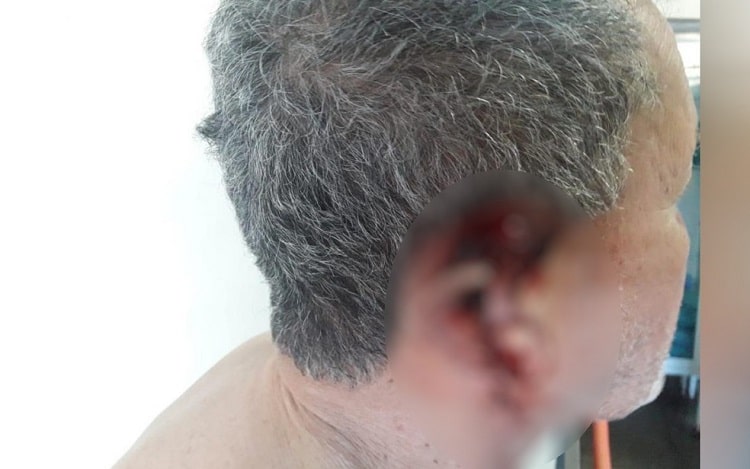 Funcionário é preso sob suspeita de cortar a orelha do patrão