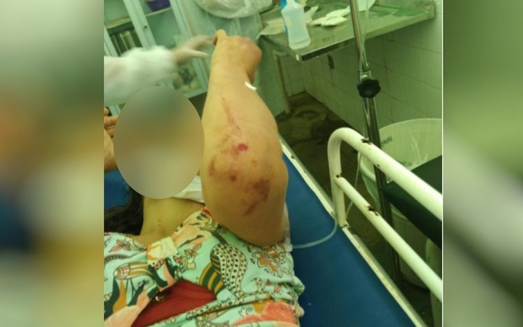 Mulher esfaqueada e espancada consegue fugir de tentativa de feminicídio