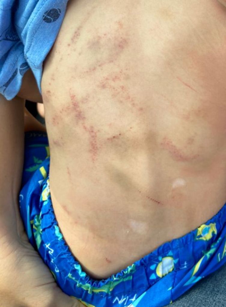 Pais são presos sob suspeita de torturar criança de 2 anos