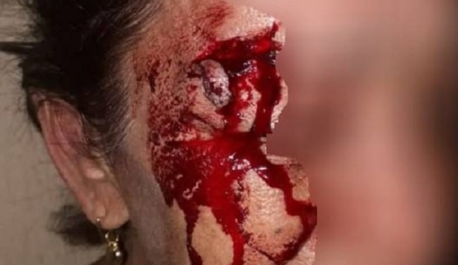 Homem é preso sob suspeita de agredir a companheira