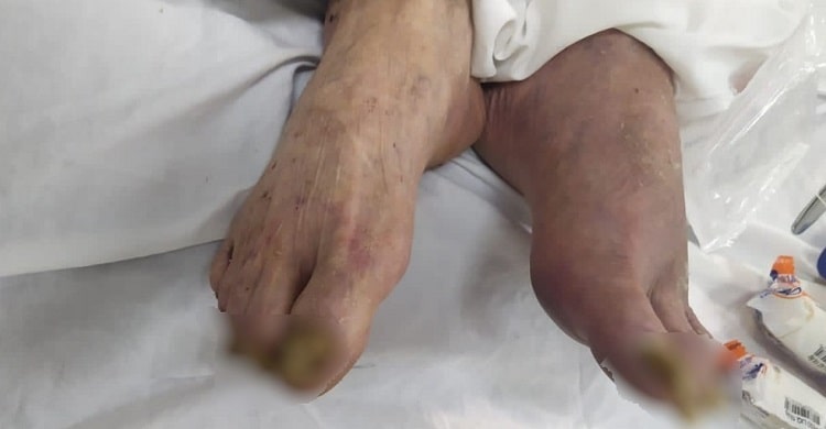 Homem é preso sob suspeita de maus-tratos contra o pai idoso