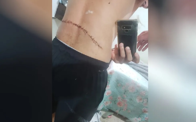 facada - gustavo lima