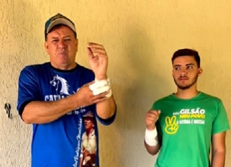 Vereador de Aparecida é atacado na porta de sua casa por pitbull