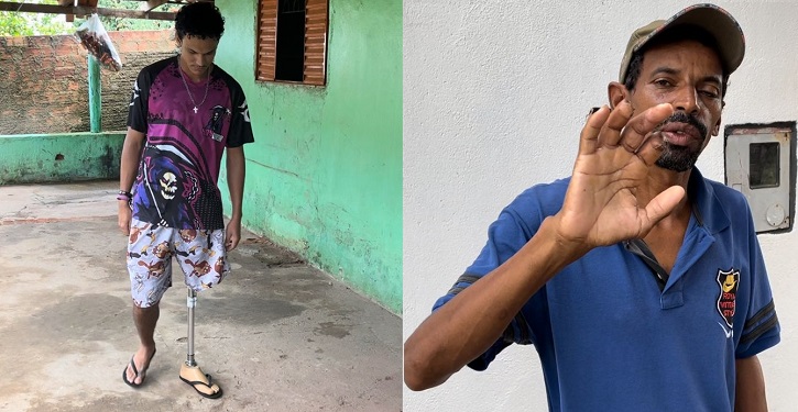 Prefeitura de Anicuns: Trabalhadores mutilados em serviço cobram justiça