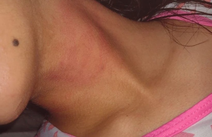 Pai é preso após enforcar e bater na filha de 17 anos