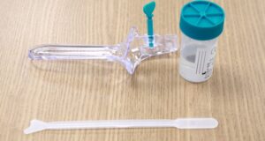 Novo teste DNA-HPV amplia o rastreamento e a detecção precoce do câncer do colo do útero pelo SUS