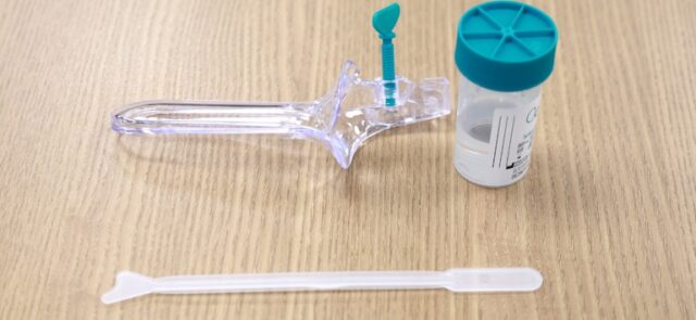 Novo teste DNA-HPV amplia o rastreamento e a detecção precoce do câncer do colo do útero pelo SUS Novo teste DNA-HPV amplia o rastreamento e a detecção precoce do câncer do colo do útero pelo SUS